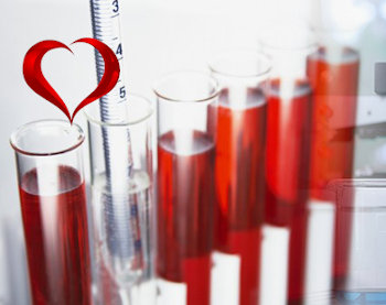 Общий анализ крови для сердца